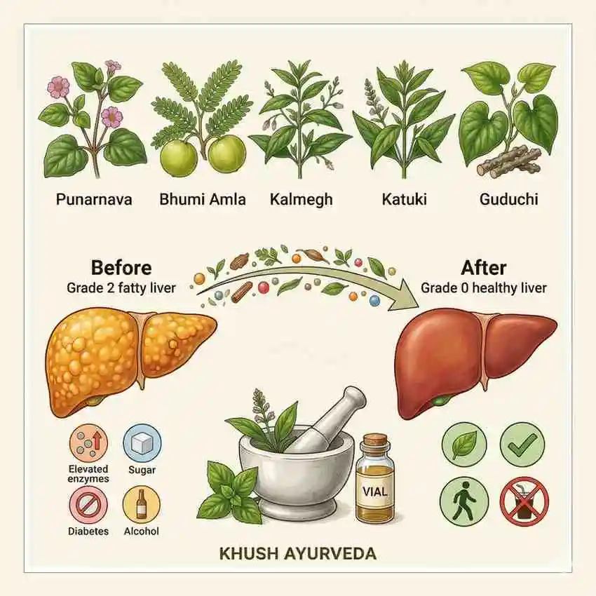Fatty liver treatment in ayurveda
